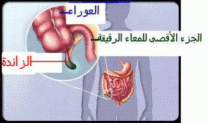 Copie de crohn54