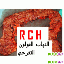 RCH2