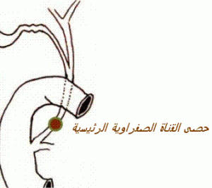 Lithiase-VBP-153x300