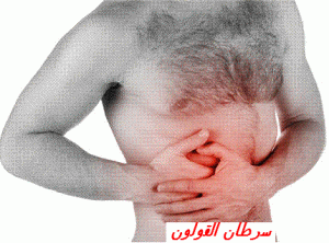 cancer colorectal