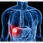 Prise en charge des métastases hépatiques du cancer colorectal (MCCR) gastro casa procto casa- سترتيجية الموقف ضد سرطان القولون و المستقيم المتنقل الى الكبد أو الميتاستاز الكبدي – PARTIE 4   الجزء الرابع