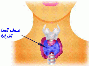 thyroidie