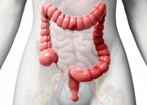 crohn du colon