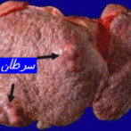 Pourquoi l’alcool fait-il grossir ? PARTIE1 الجزء الأول