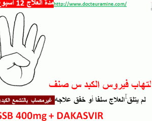 G4 1111111111133