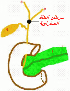 cholangiocarcinome-hilaire