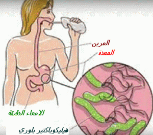 HBPHBPحححححححح