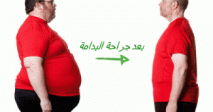 6bougebbbbbbbbbbb
