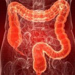 علاج متلازمة الأمعاء المنفعلة  الموقف الحالي الجزء التاسع Traitement de l’intestin irritable ou on est-Gastro-entérologue, proctologue 9ème partie gastro casa