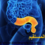 Cancer du rectum , cancer colorectal , syndromes de prédisposition héréditaire au cancer colorectal – syndromes de prédisposition héréditaire au cancer colorectal gastro casa procto casa gastroentérologue casa  سرطان القولون والمستقيم: أي موقف طبي –جراحي يتحتم اتخاذه عمليا ؟- – – Partie 12  ألجزء الثاني عشر