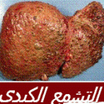 HEPATITE VIRALE “E”-التهاب الكبد القيروسي “E ” -gastro casa procto casa- – PARTIE 7 االجزء السابع