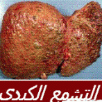Manifestations hépatiques et extra hépatiques du virus de l’hépatite C ( VHC ) gastro casablanca procto casa الظاهرات الكبدية و الخارجة عن الكبد الناجمة عن فيروس الكبد س – PARTIE 4 الجزء الرابع –