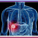 Manifestations hépatiques et extra hépatiques du virus de l’hépatite C ( VHC ) الظاهرات الكبدية و الخارجة عن الكبد الناجمة عن فيروس الكبد س  Partie 1 الجزء الأول