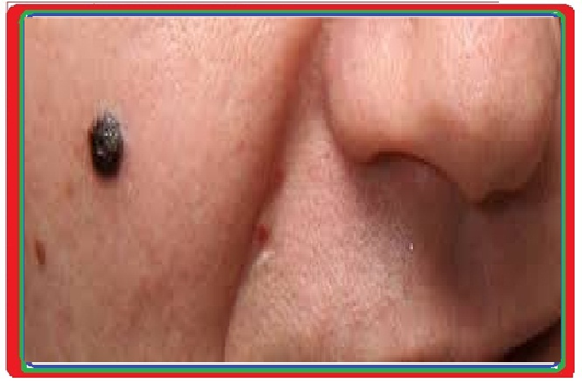 L’attribut alt de cette image est vide, son nom de fichier est image-35.png.
