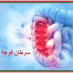 القناة الهضمية أخذالموقف تجاه سرطان فوهة ااشرج Ce qui change nos pratiques en cancérologie digestive Prise en charge du cancer de l’anus – gastro casa procto casa