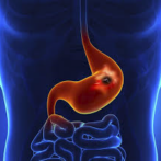 Eradication systémique de Helicobacter pylori en prévention du cancer gastrique : Qu’en sommes-nous ?الانقراض المنتظم لجرثومة هيليكوباكتير بلوري كوقاية ضد الإصابةPartie 5 الجزء الخامس