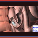 Diverticulose du grêle : diagnostic et prise en charge دبفيرتيكولوز أو داء ردج الأمعاء الدقيقة : التشخيص و أخذ الموقف- Partie 5 الجزء الخامس