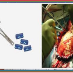 Diverticulose du grêle : diagnostic et prise en charge دبفيرتيكولوز أو داء ردج الأمعاء الدقيقة : التشخيص و أخذ الموقف- Partie 13 الجزء الثالث عشر