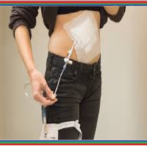 Diverticulose du grêle : diagnostic et prise en charge دبفيرتيكولوز أو داء ردج الأمعاء الدقيقة : التشخيص و أخذ الموقف- Partie 15 الجزء الخامس عشر