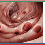 La maladie amibienne parmi d’autrres aparasitoses Principales parasitoses à tropisme hépatobiliaire Partie 4   الجزء الرابع  تابع