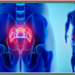 Les algies anales « essentielles » آلالام الأساسية لفوهة الشرج و المستقيم Partie 1  الجزء الأول