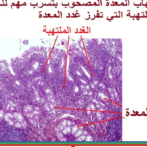 كيف تتم جودة مراقبة اصابات المعدة المهيئة الأرضية لتطور السرطان ؟  Comment peut-on faire le diagnostic de dysplasie de la muqueuse gastrique ? gastro casa procto casa HBP- Partie 1 الجزء الأول