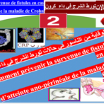مرض كرون المعروف مع عدم وجود تورط الشرج الواعي المعروف –   s atteinte ano-périnéale connue pPartie 2   الجزء الثاني