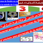 Pour la prévention de l’atteinte ano-périnéal e de la maladie de Crohn -تورط الشرج من مرض كرون