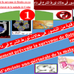 -الوقاية من الناسور في حالات تورط الشرج في داء  كرون – Comment prévenir la survenue de fistules en cas d’atteinte ano-périnéale de la maladie de Crohn -؛-الجزء الأول  Partie 1