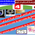 !Pour la prévention des complications de l’atteinte ano-périnéale de la maladie de Crohn !اية من مضاعفات تورط الشرج من مرض كرون -الجزء الرابع Partie4